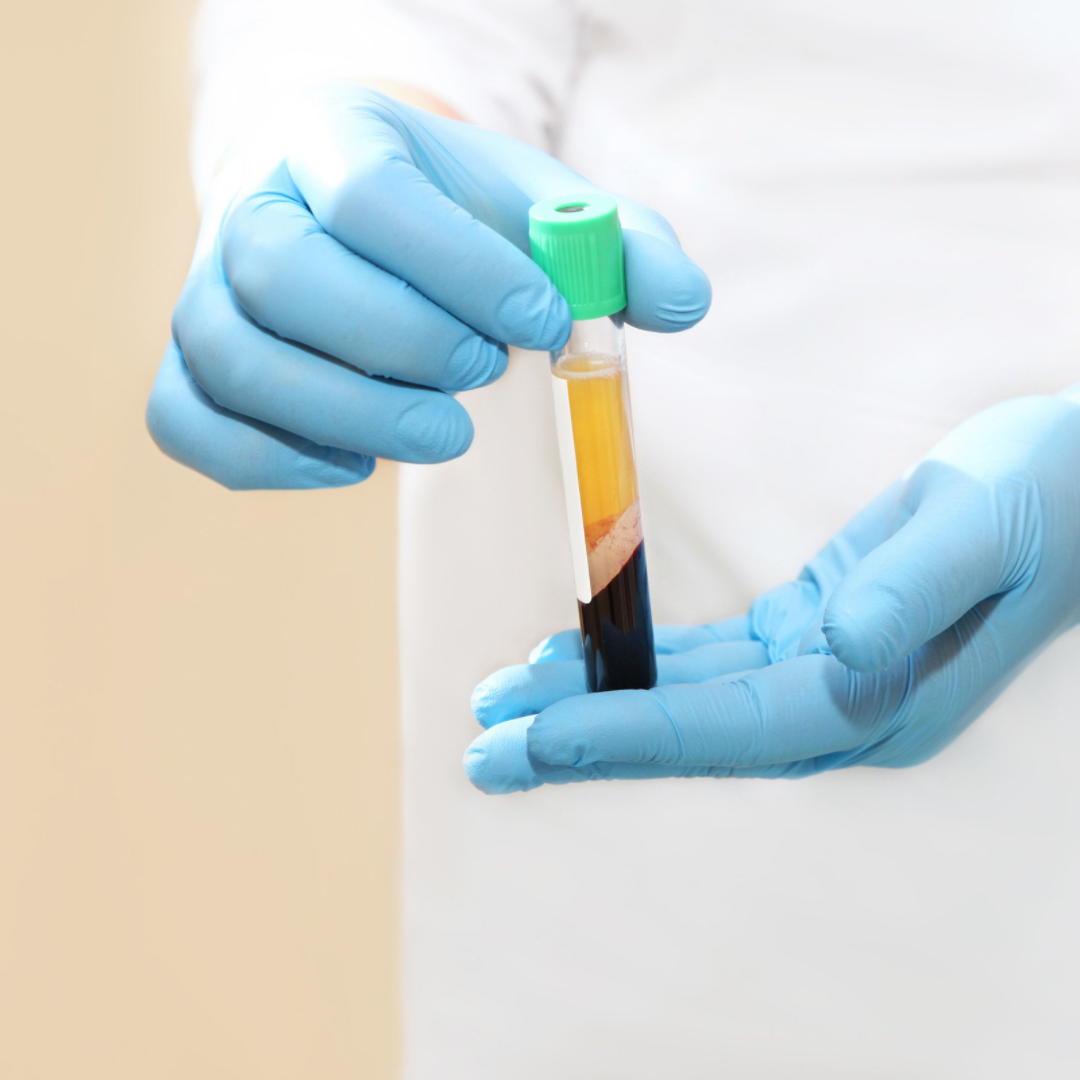 PRP – Facial Skin Rejuvenation