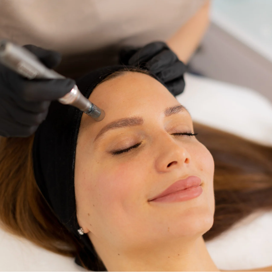 Microneedling + i Fill Ceuti Shot