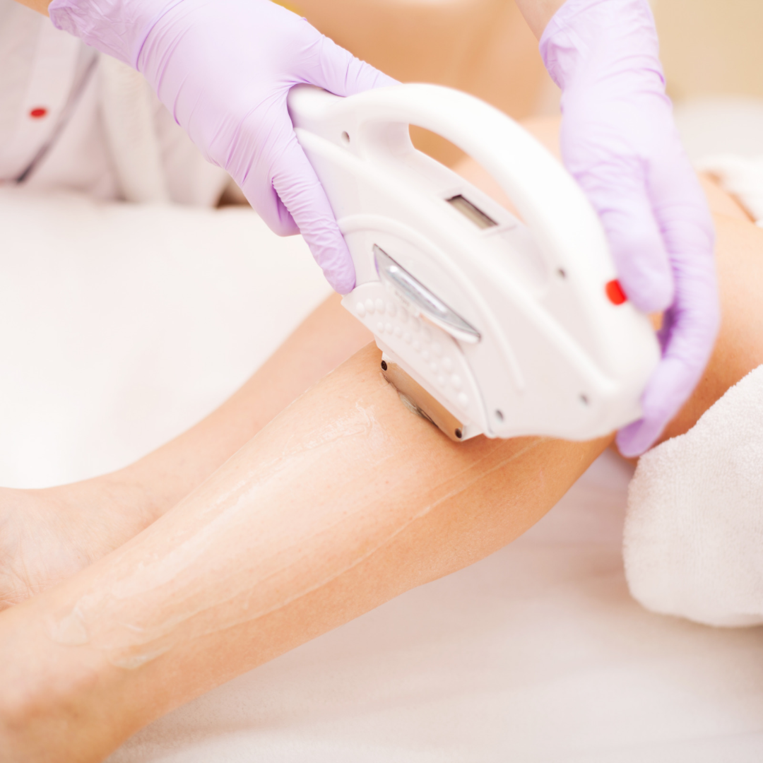 Laser Hair Removal