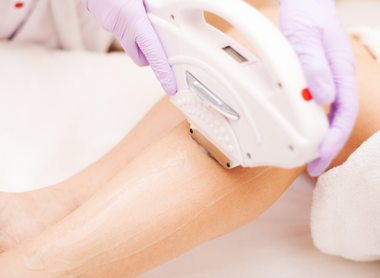 Laser Hair Removal