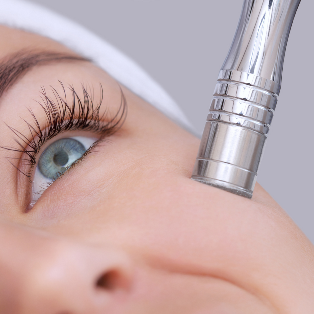 Microdermabrasion – Viora Pristine