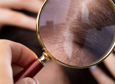 PRP Hair Loss Treatment