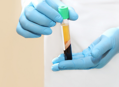 PRP – Facial Skin Rejuvenation
