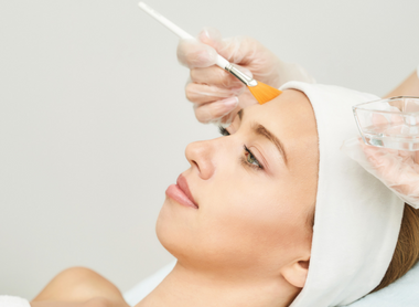 Chemical Peel