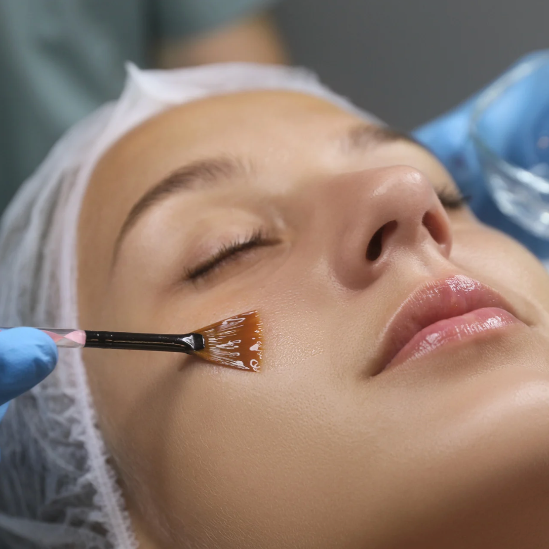 Light Peel