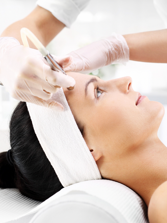 Microdermabrasion